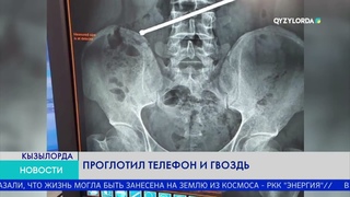 ПРОГЛОТИЛ ТЕЛЕФОН И ГВОЗДЬ
