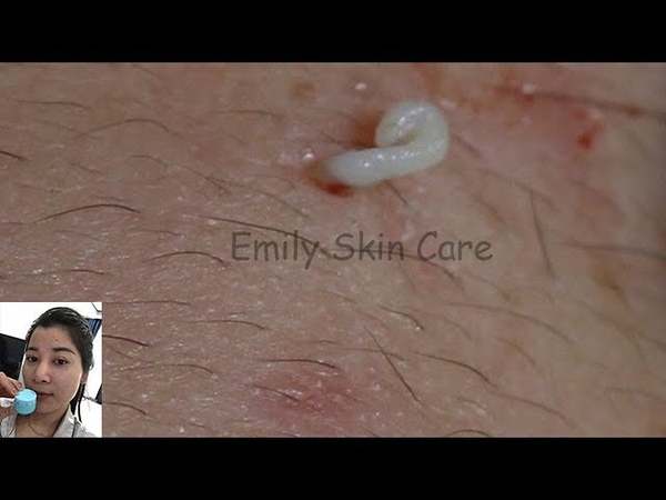 Most Satisfying Video Face Skin Care with Calm Music