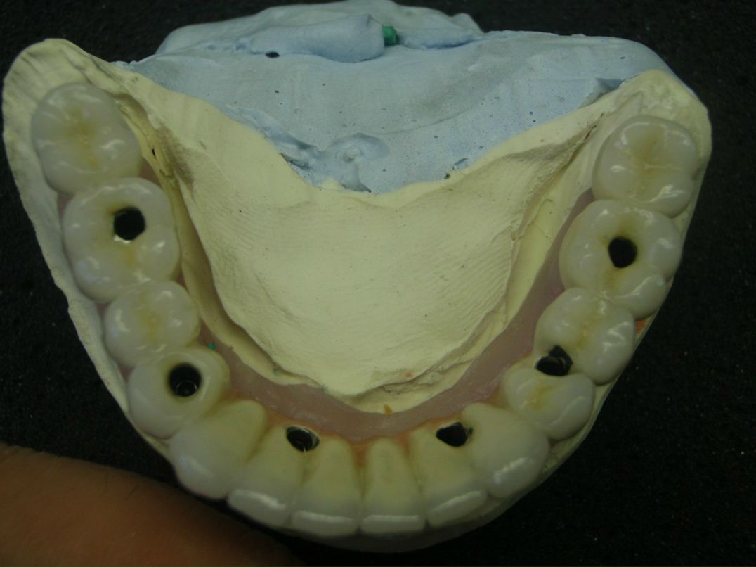 Эрнест Абрамян | Москва