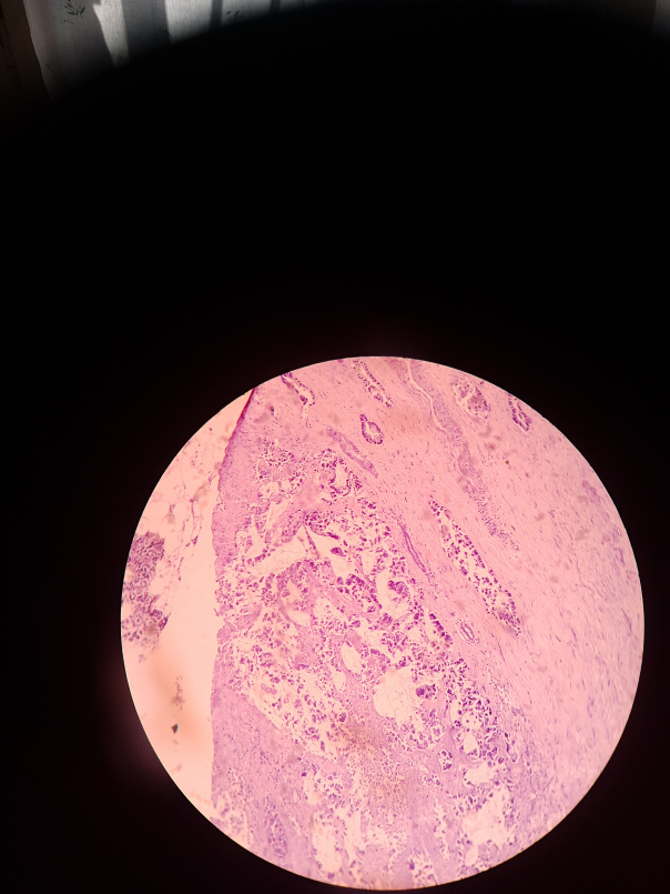 Рак каждый день /Раковые узоры /Everyday Cancer | Только уникальные ...